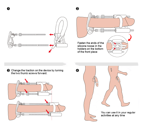 Extensor de Pene Ajustable CALEXOTICS - Image 4